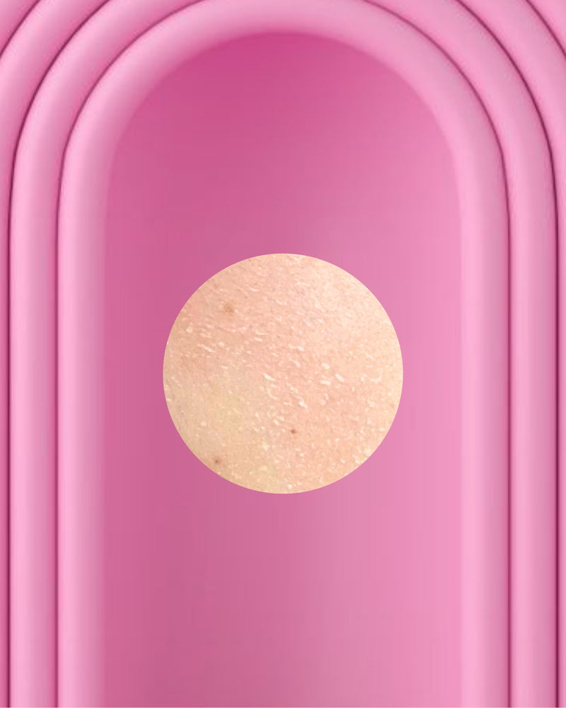 Išsausėjusi / Tempianti oda