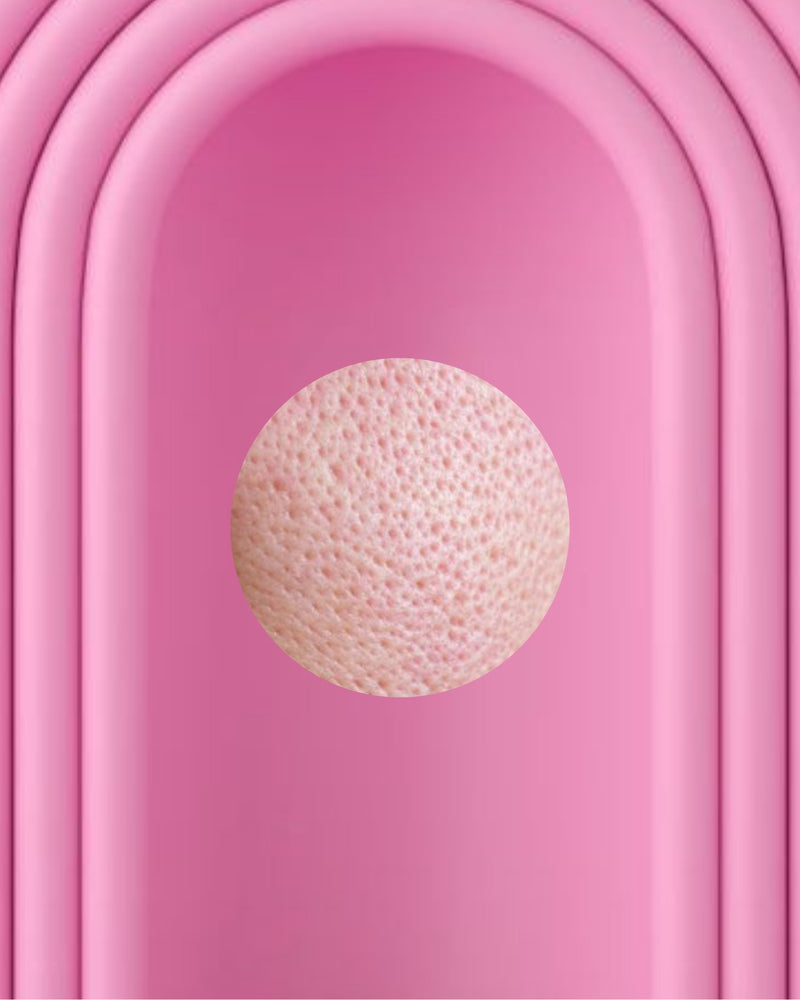 Didelės poros / Porėta oda